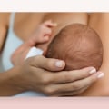 Is Laser Hair Removal Safe During Breastfeeding? A Comprehensive Guide