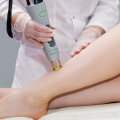 What You Need to Know About Contraindications for Laser Hair Removal