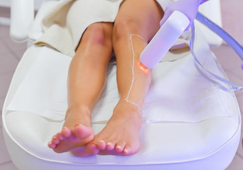 10 Reasons Why Laser Hair Removal May Not Work For You