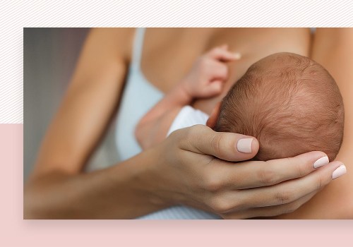 Is Laser Hair Removal Safe Postpartum? - An Expert's Perspective