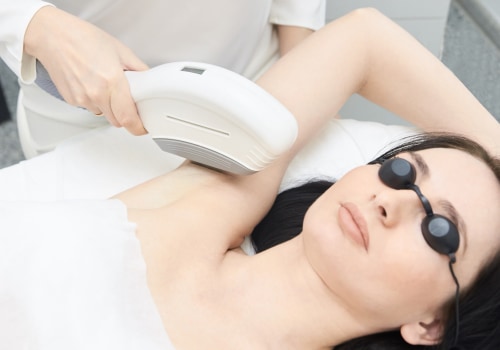 Finding a Reputable Clinic for Laser Hair Removal