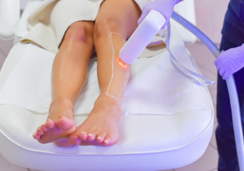 Ensuring Laser Hair Removal is Effective