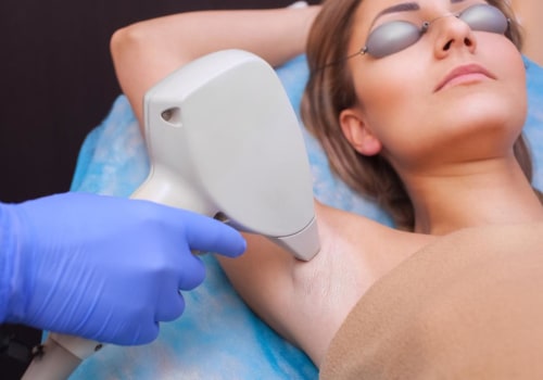 The Ultimate Guide to Laser Hair Removal: What is the Target of Permanent Hair Removal?